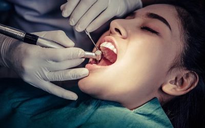 Root Canal Treatment11