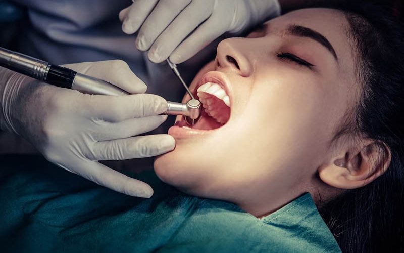 Root Canal Treatment11