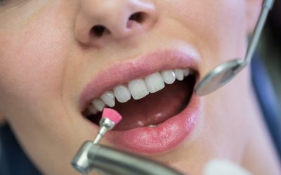 Dentist examining a female patient with tools at dental clinic